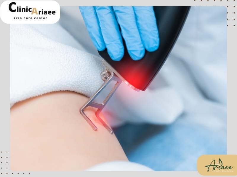 چگونه بعد از لیزر بیکینی برای رابطه جنسی آماده شویم؟