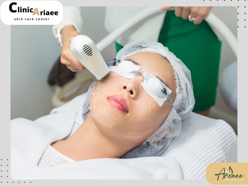 چگونه از سفید شدن مو بعد از لیزر جلوگیری کنیم؟