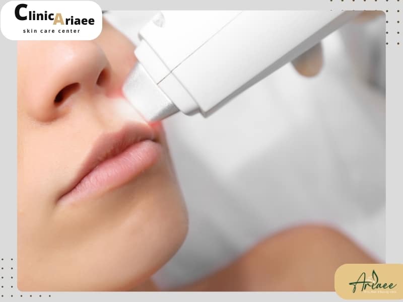 آیا اشعه لیزر ضرر دارد؟