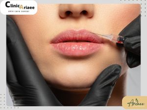۱۲ توصیه مهم در مراقبت‌های بعد از تزریق ژل