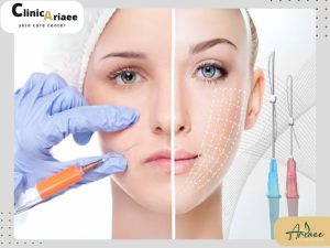 تزریق چربی بهتر است یا لیفت نخ