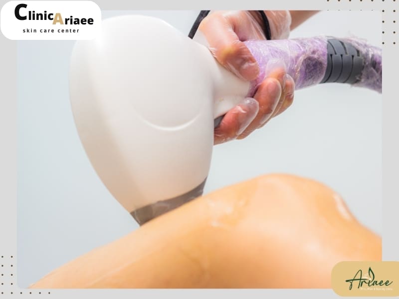 آیا رابطه جنسی بعد از لیزر بیکینی میتواند عوارضی را ایجاد کند؟
