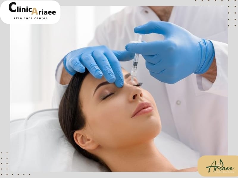 روش انجام بوتاکس بینی( بوتاکس بینی چگونه است؟)