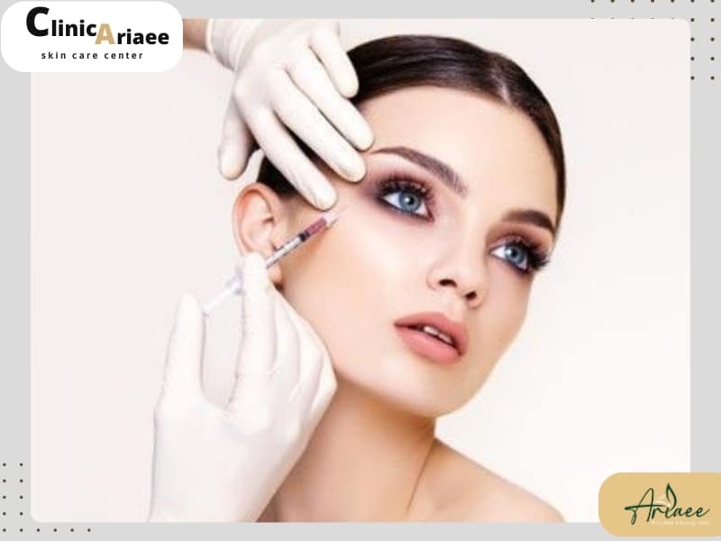 مراقبت‌های بعد از بوتاکس چشم گربه‌ای