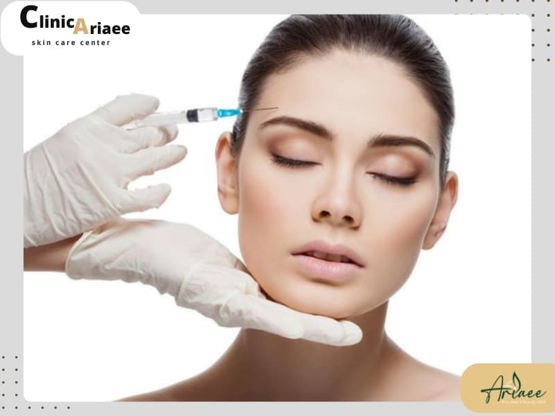 بوتاکس چشم گربه‌ای