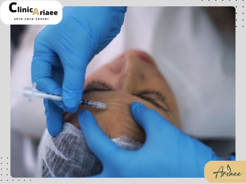 هزینه بوتاکس پیشانی