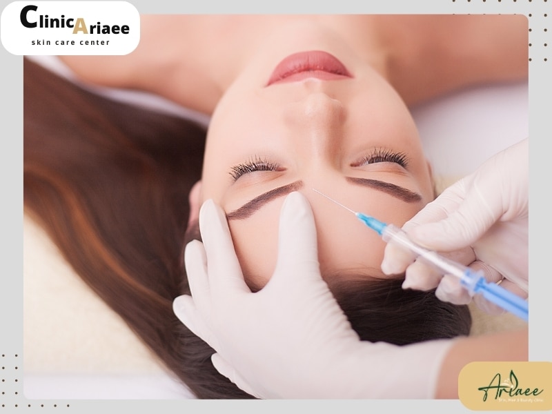بوتاکس پیشانی برای چه کسانی مناسب است؟