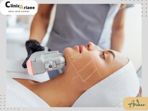هایفوتراپی بهتر است یا بوتاکس