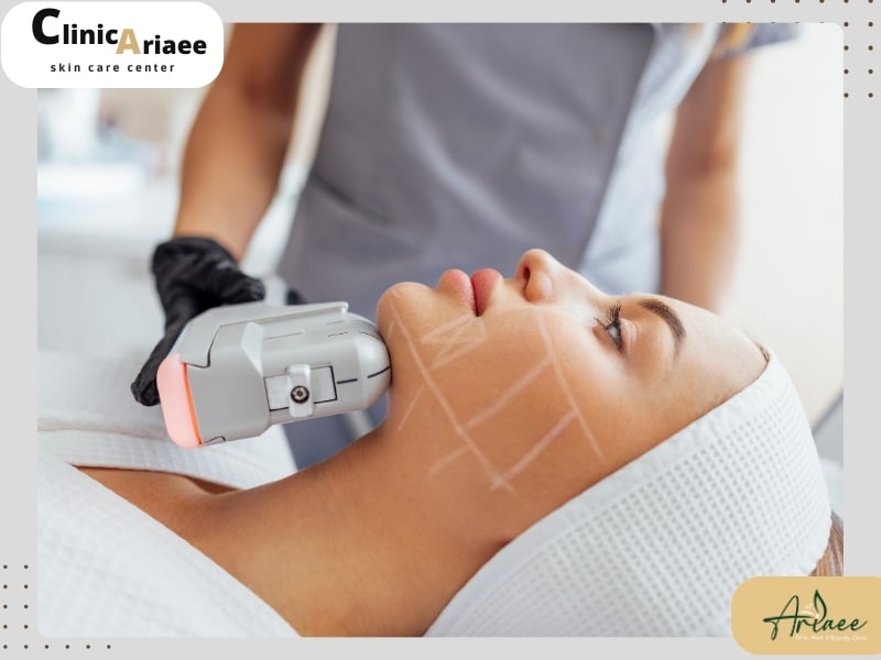 هایفوتراپی بهتر است یا بوتاکس
