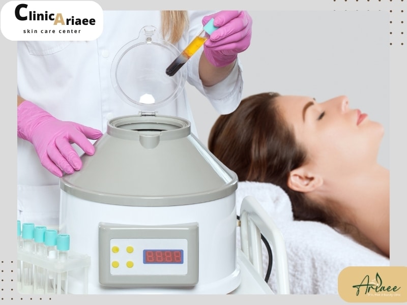 آمادگی برای انجام پی ‌آر‌ پی سخت‌تر است یا مزوتراپی؟