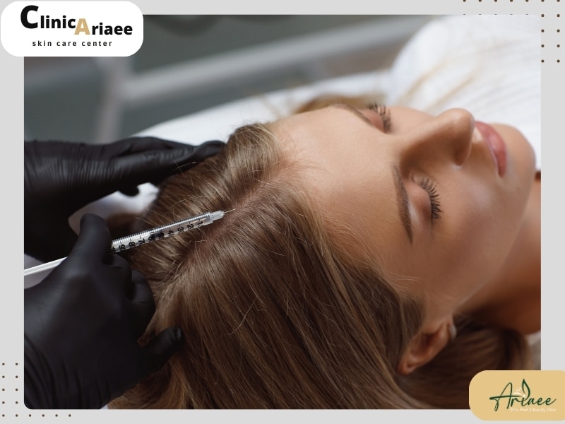 از نظر عوارض و خطرات prp مو بهتره یا مزوتراپی؟