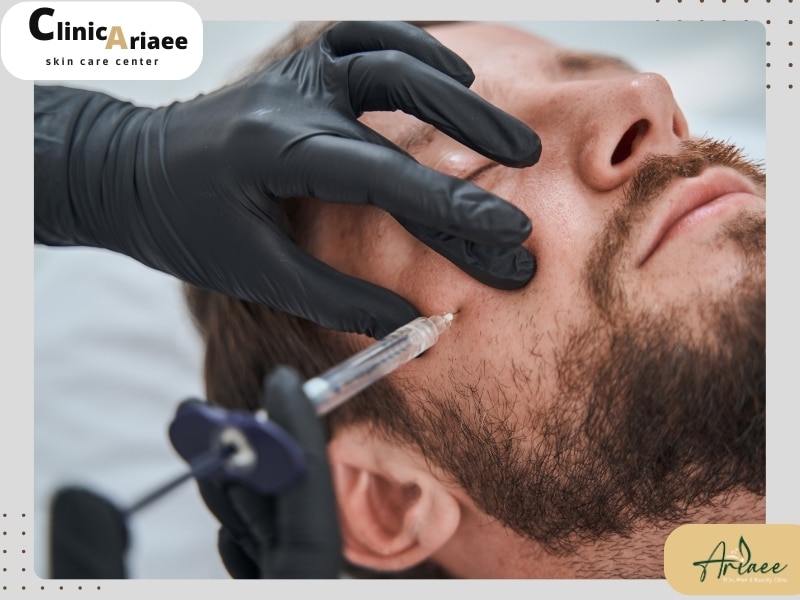 مزوتراپی ریش چیست؟