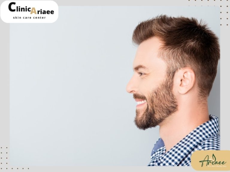 مزوتراپی ریش