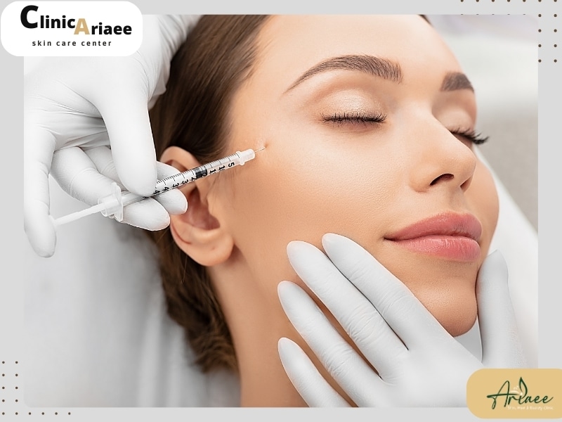 روش انجام مزوتراپی صورت