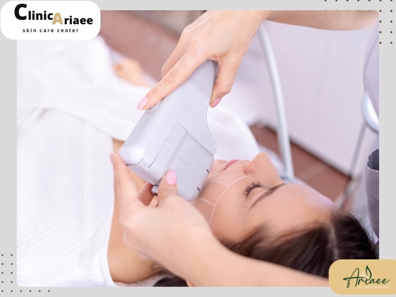 آمادگی برای انجام هایفو دور چشم