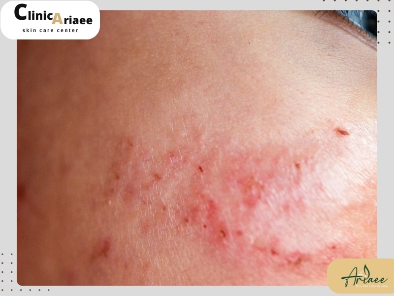 نتیجهگیری و راهنمای مراجعه به دکتر