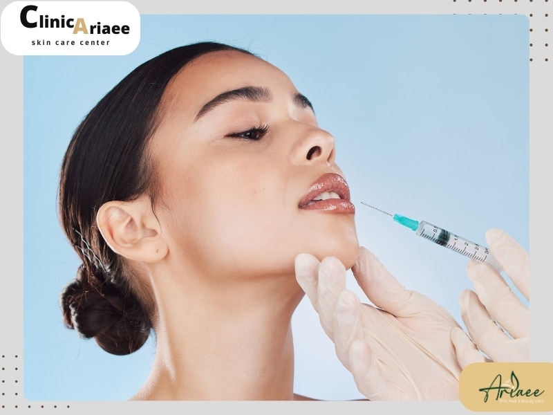 بوتاکس لب برای چه کسانی مناسب است؟