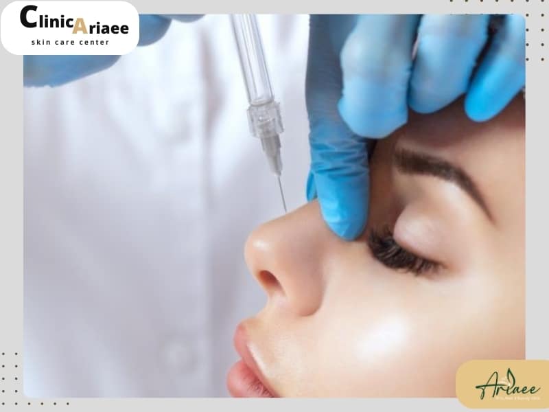 بوتاکس بینی برای چه کسانی مناسب است؟