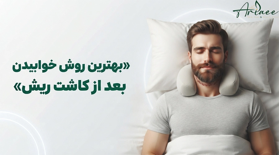 بهترین روش خوابیدن بعد از کاشت ریش