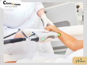 دلایل نریختن موها بعد از لیزر