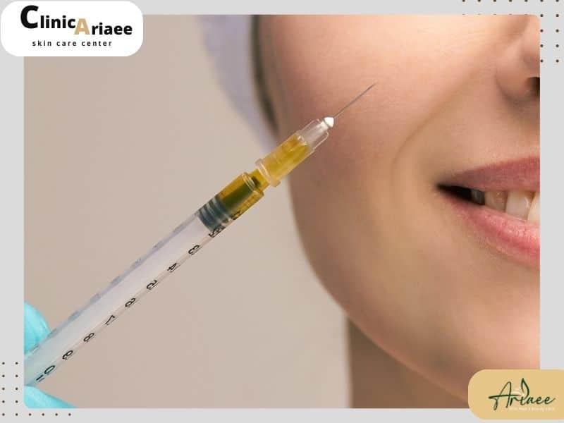 روش تزریق چربی و مراحل آن