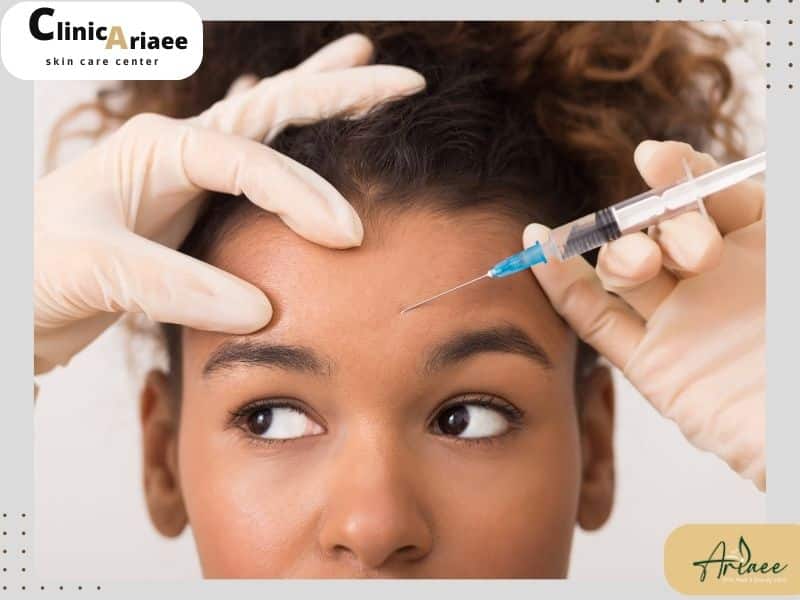  آیا پس از تزریق بوتاکس، پوست به حالت اولیه برمی‌گردد؟