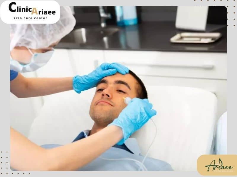 نوع هفتم از بهترین دستگاه جوانسازی پوست | کربوکسی