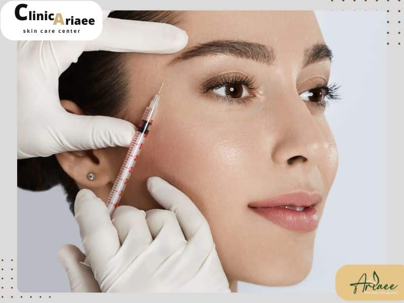 تزریق چربی به کدام نواحی صورت ماندگاری بیشتری دارد؟