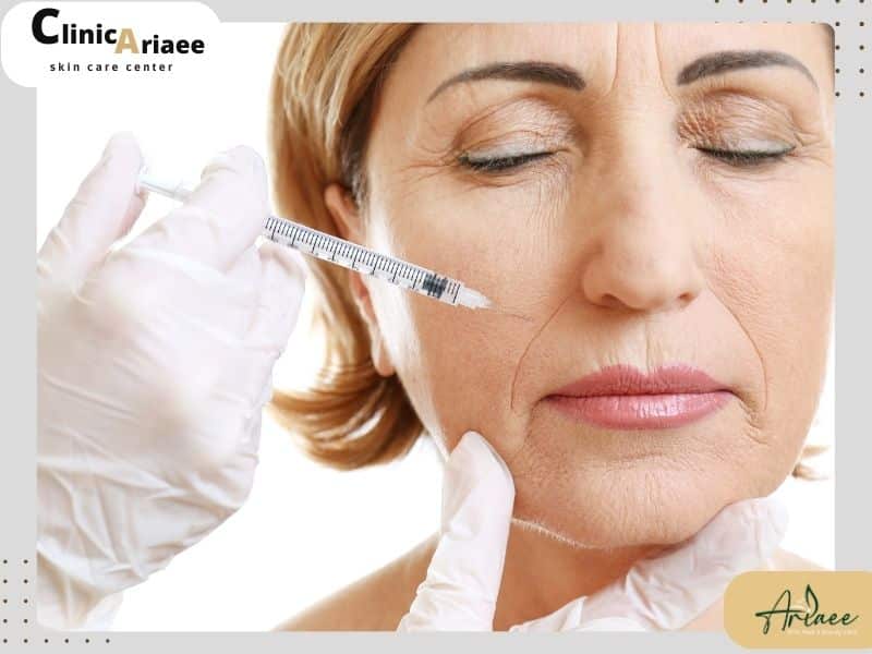 تاثیر سن در ماندگاری چربی در صورت