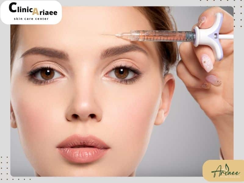 تزریق چربی به کدام نواحی صورت ماندگاری بیشتری دارد؟