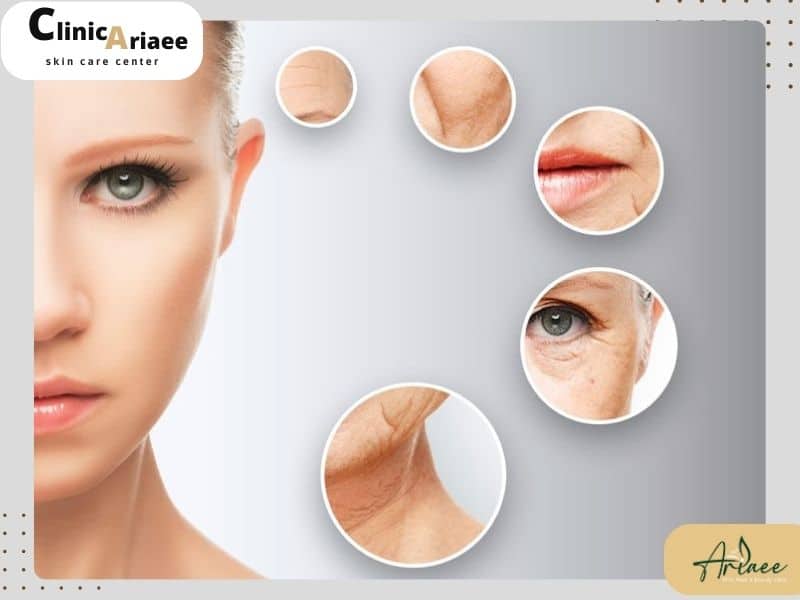 مزایای هایفوتراپی
