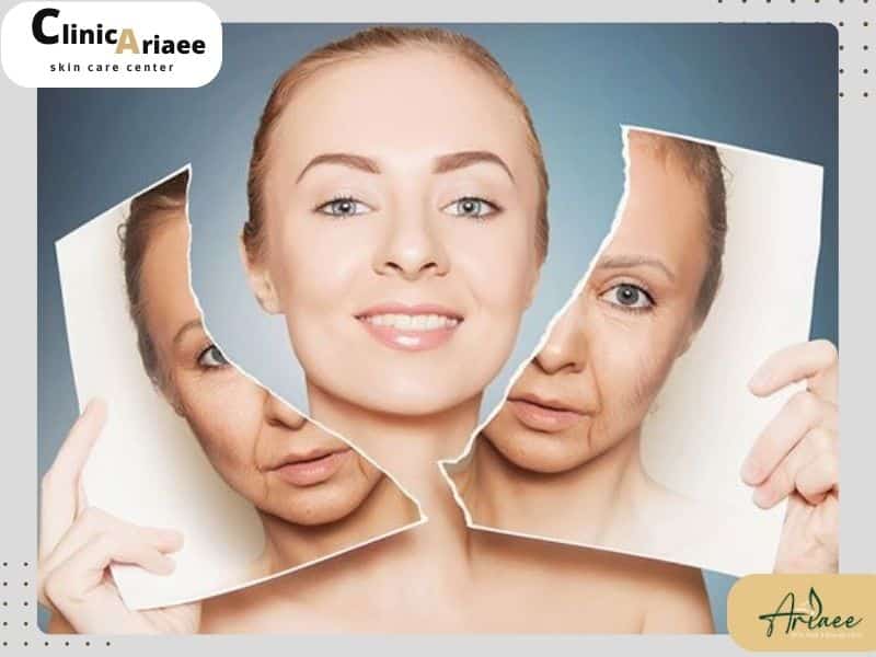 مراقبت های بعد از هایفوتراپی