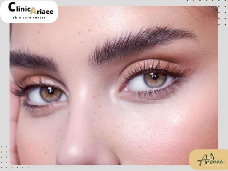 اسکار و جای زخم بعد از کاشت ابرو