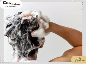 نحوه صحیح شستن سر بعد از کاشت مو
