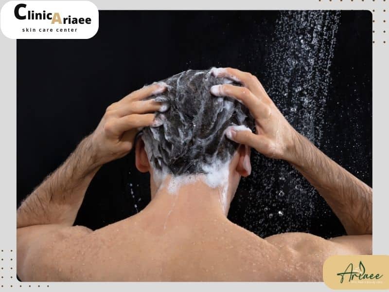  مراحل شست‌وشوی سر بعد از کاشت مو