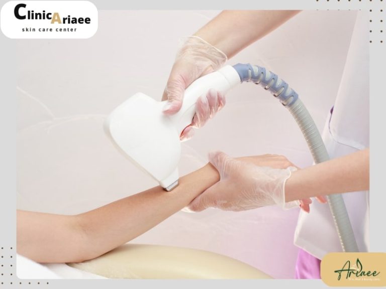 عوامل مؤثر در ریزش موهای زائد پس از لیزر