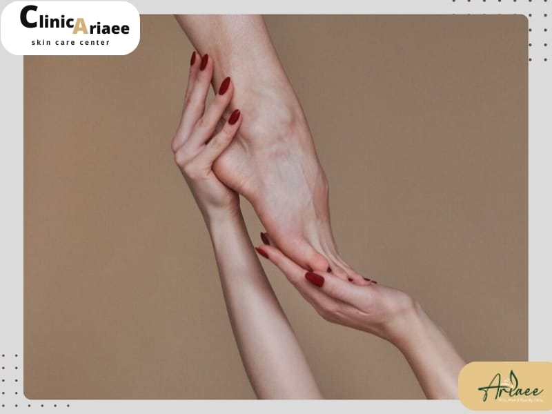 عوامل مؤثر در ریزش موهای زائد پس از لیزر