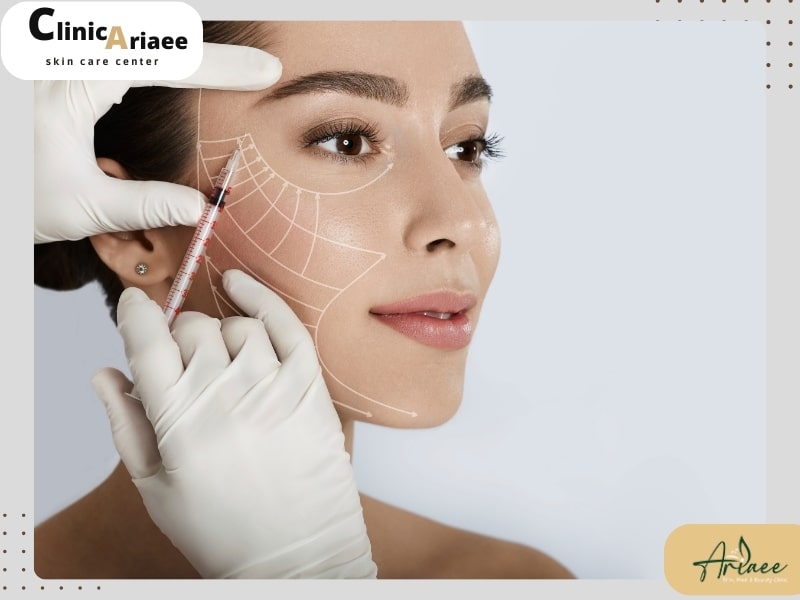 هزینه زاویه‌سازی صورت با تزریق چربی بیشتر است یا ژل؟
