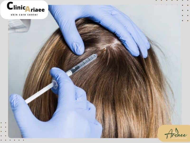 عوارض مزوتراپی