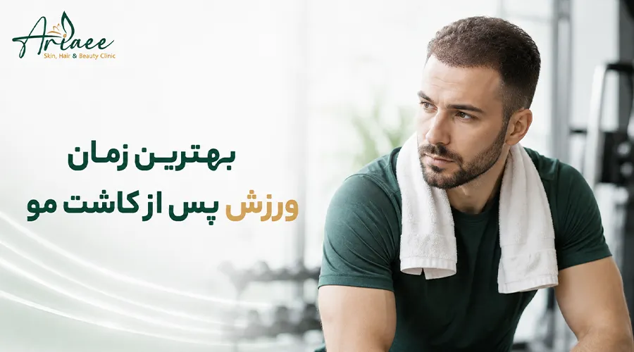 بهترین زمان ورزش پس از کاشت مو