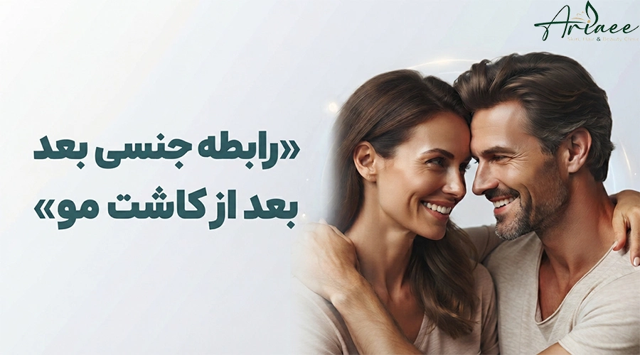 رابطه جنسی بعد از کاشت مو