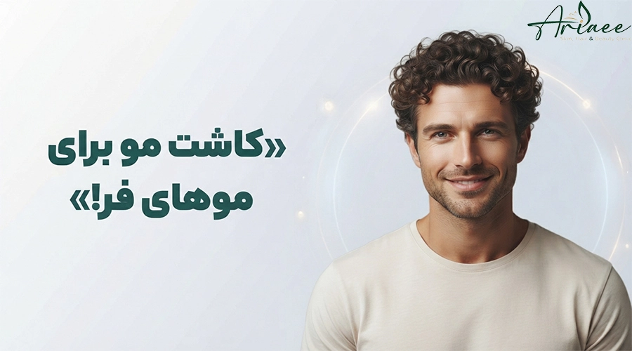 کاشت مو برای موهای فر!