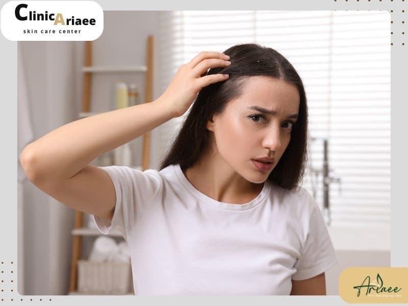 دلایل خارش سر و ریزش مو