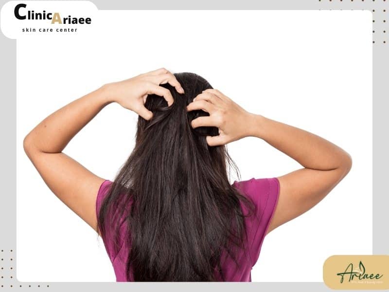 درماتیت آتوپیک