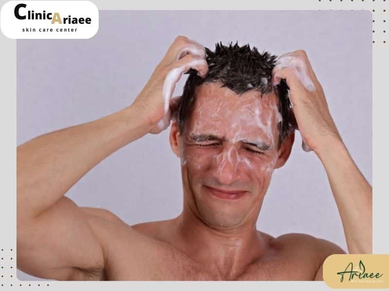 مراقبت از ناحیه اهدا کننده (بانک مو)