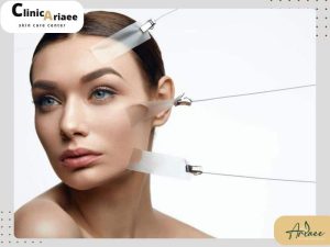 اندولیفت بهتر است یا لیفت با نخ