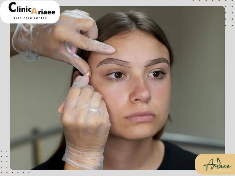  کاشت ابرو چیست؟