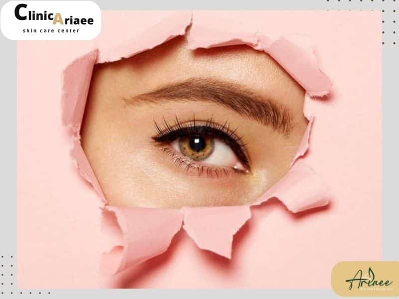  سایر روش‌های اصلاح ابرو پس از کاشت