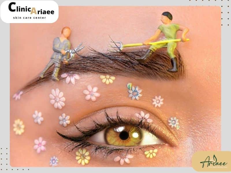  چه زمانی می‌توان ابروهای کاشته شده را قیچی کرد؟