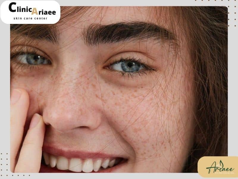 راه‌های جلوگیری از ریزش ابرو پس از کاشت